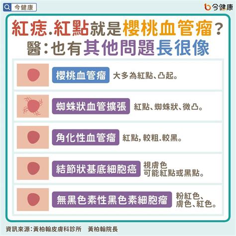 為什麼身上會有痣|皮膚長「紅痣」會怎樣？跟黑痣有何不同？會是皮膚癌。